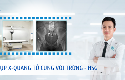 CHỤP X-QUANG TỬ CUNG VÒI TRỨNG - HSG